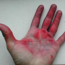 A takhle vypadá ruka, která po skončení pochodu sundávala fáborky z červeného krepového papíru